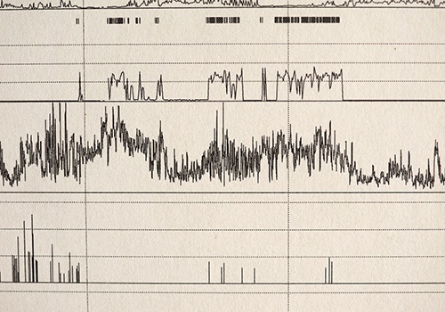 Sleep apnea test results