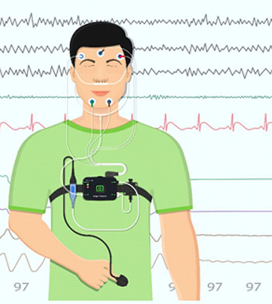 digital illustration of a sleep test